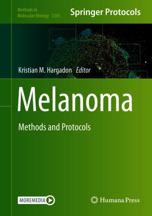 Melanoma image