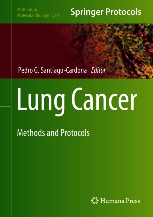 Lung Cancer image