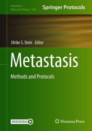 Metastasis image