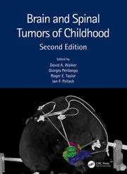 Brain and spinal tumors of childhood圖片