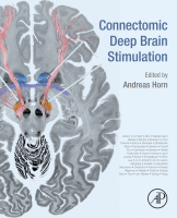 Connectomic deep brain stimulation image