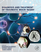 Diagnosis and treatment of traumatic brain injury image