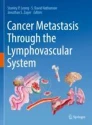 Cancer Metastasis Through the Lymphovascular System image