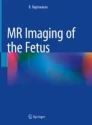 MR Imaging of the Fetus圖片