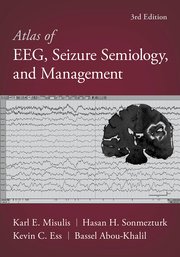 Atlas of EEG, seizure semiology, and management image