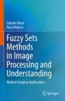 Fuzzy sets methods in image processing and understanding image