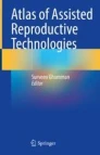 Atlas of assisted reproductive technologies圖片
