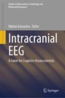 Intracranial EEG image