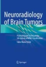 Neuroradiology of brain tumors圖片