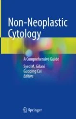 Non-neoplastic cytology image