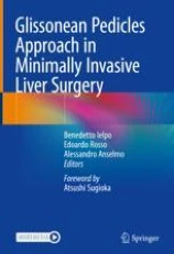 Glissonean pedicles approach in minimally invasive liver surgery圖片