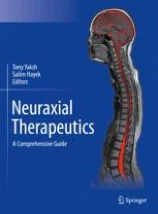 Neuraxial therapeutics image