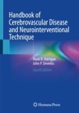 Handbook of cerebrovascular disease and neurointerventional technique圖片