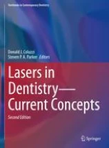 Lasers in dentistry -- current concepts image