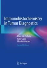 Immunohistochemistry in tumor diagnostics image