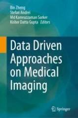 Data driven approaches on medical imaging image