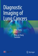 Diagnostic imaging of lung cancers
 image