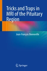 Tricks and traps in MRI of the pituitary region image
