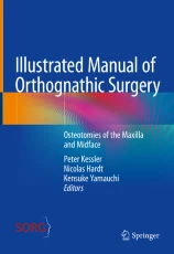 Illustrated manual of orthognathic surgery image