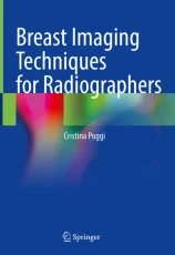 Breast imaging techniques for radiographers image