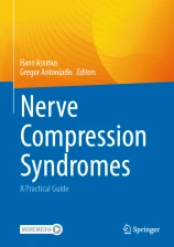 Nerve compression syndromes image