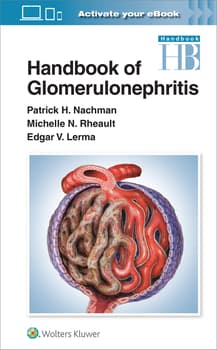 Handbook of Glomerulonephritis image