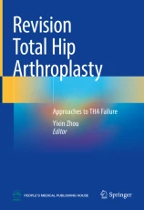 Revision Total Hip Arthroplasty image