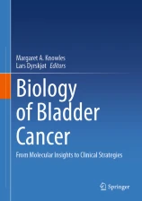 Biology of Bladder Cancer image