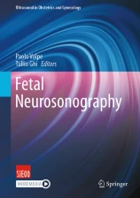 Fetal Neurosonography image