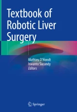 Textbook of Robotic Liver Surgery image
