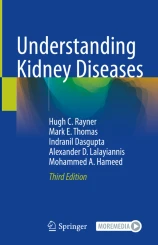 Understanding Kidney Diseases圖片