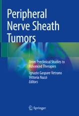 Peripheral Nerve Sheath Tumors圖片
