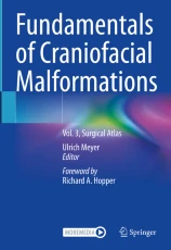 Fundamentals of Craniofacial Malformations圖片