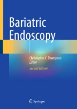 Bariatric Endoscopy圖片