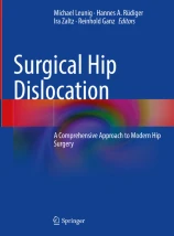 Surgical Hip Dislocation圖片
