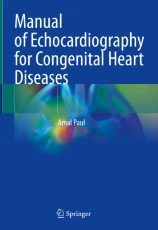 Manual of Echocardiography for Congenital Heart Diseases圖片