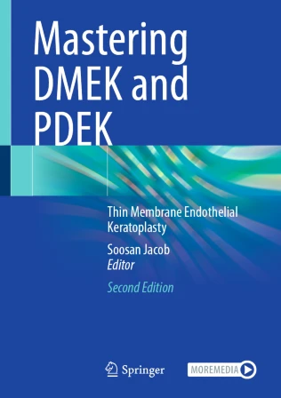 Mastering DMEK and PDEK圖片