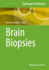 Brain Biopsies image