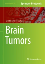 Brain Tumors圖片