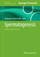 Spermatogenesis圖片