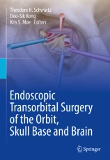 Endoscopic Transorbital Surgery of the Orbit, Skull Base and Brain圖片