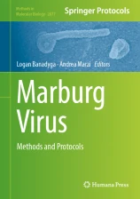 Marburg Virus image