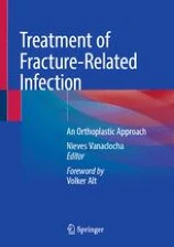 Treatment of Fracture-Related Infection image