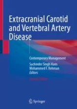 Extracranial Carotid and Vertebral Artery Disease圖片