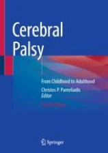 Cerebral Palsy image