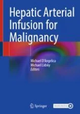 Hepatic Arterial Infusion for Malignancy image
