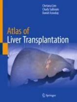 Atlas of Liver Transplantation image