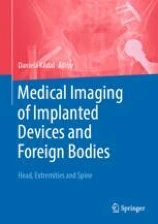 Medical Imaging of Implanted Devices and Foreign Bodies image