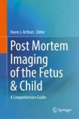 Post Mortem Imaging of the Fetus & Child image