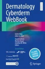 Dermatology Cyberderm WebBook image